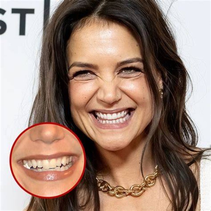 10 Celebrities With Full Dentures CARDS DENTAL