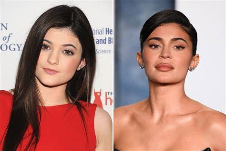 A Journey Before Plastic Surgery
