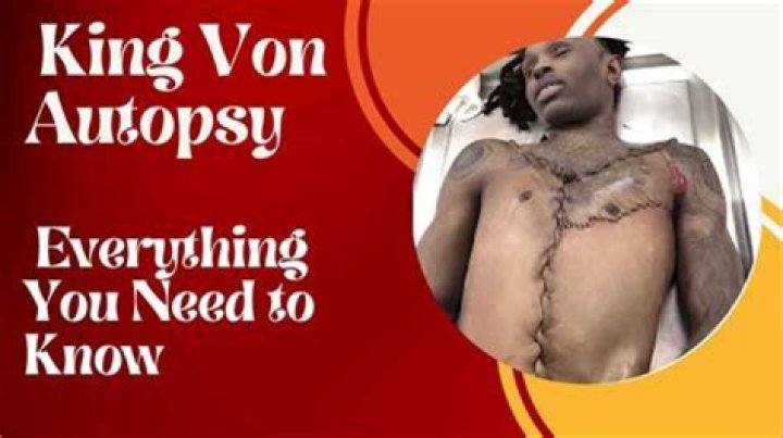 Disturbing Details: King Von Autopsy Images Released
