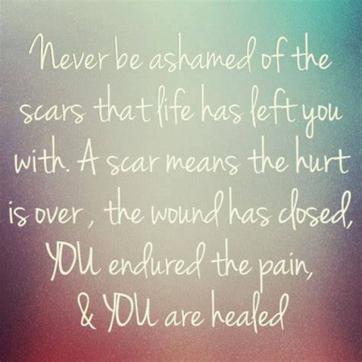 Healing Surgery Quotes Inspirational. QuotesGram