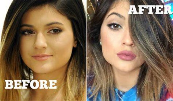 How to look like Kylie Jenner