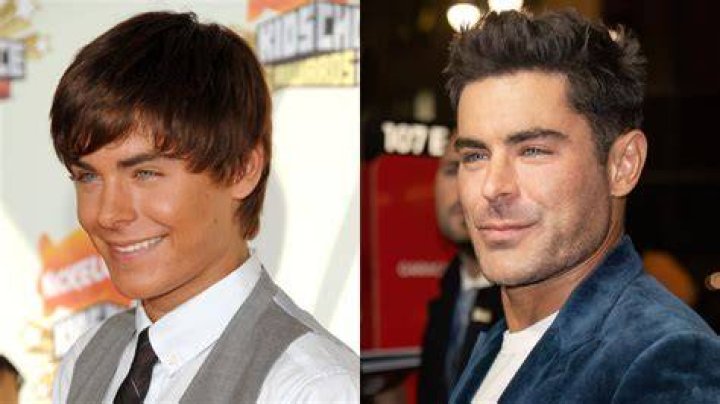 ¿Exceso de bótox? Zac Efron recibe duras críticas tras radical cambio
