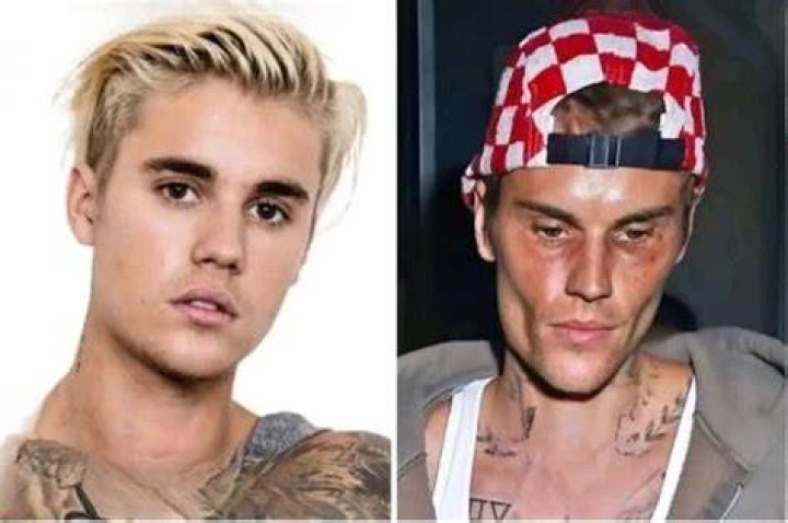 Justin Bieber's Tragic Death: A Heartbreaking Loss