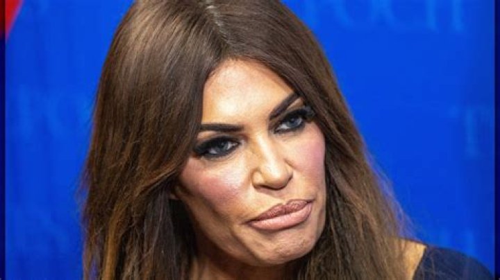 Kimberly Guilfoyle Face: Uncovering Her Unique Features