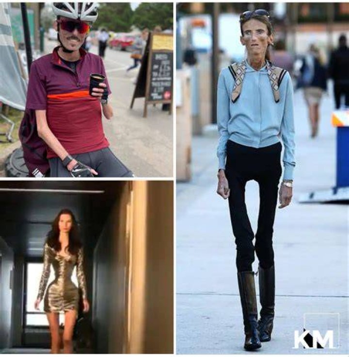 Meet The Incredibly Thin "World's Skinniest Person"