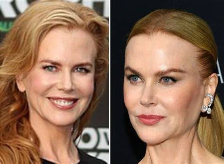 Nicole Kidman's Not-So-Secret Surgery: The Truth About Her Fake Boobs