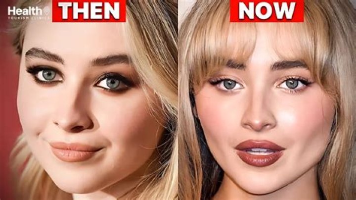 Sabrina Carpenter Plastic Surgery The Secret of Her DollLike Appearance!