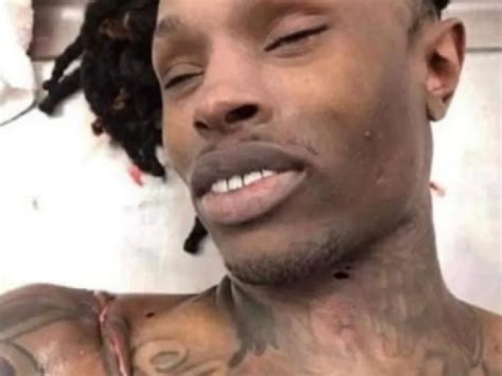 Shocking Autopsy Photo Of King Von Revealed: The Tragic Aftermath