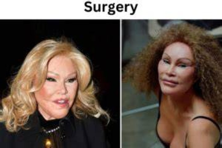The Enigmatic Transformation Of Jocelyn Wildenstein: A Journey Of Excess And Controversy