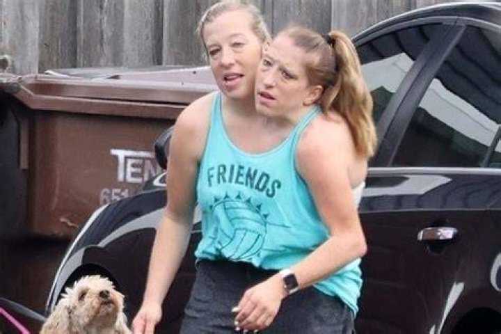 The Heartbreaking Loss: Abby And Brittany Hensel Family Tragedy Of 2021