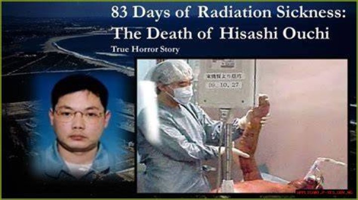 The Life And Legacy Of Hisashi Ouchi: A True Story Of Tragedy And Survival