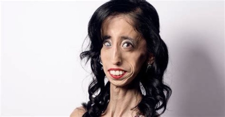The Surprising Truth About Being Dubbed The Ugliest Person In The World