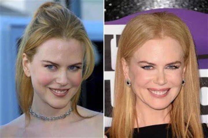 Unveiling Nicole Kidman's Cinematic Journey Through The Ages