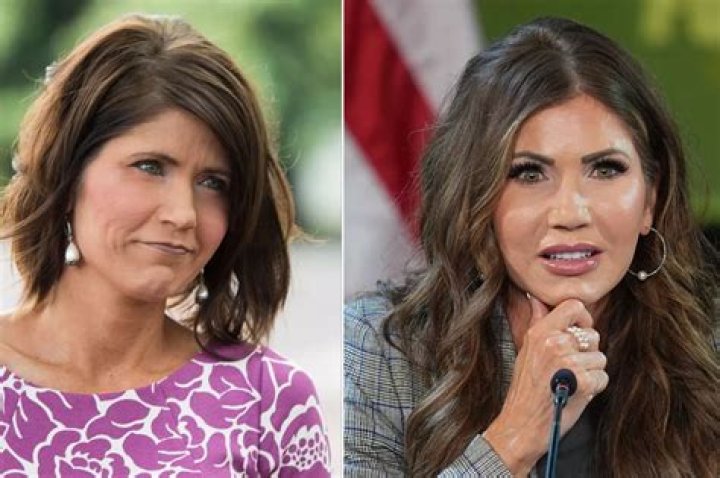 Unveiling The Truth Behind Kristi Noem's Plastic Surgery
