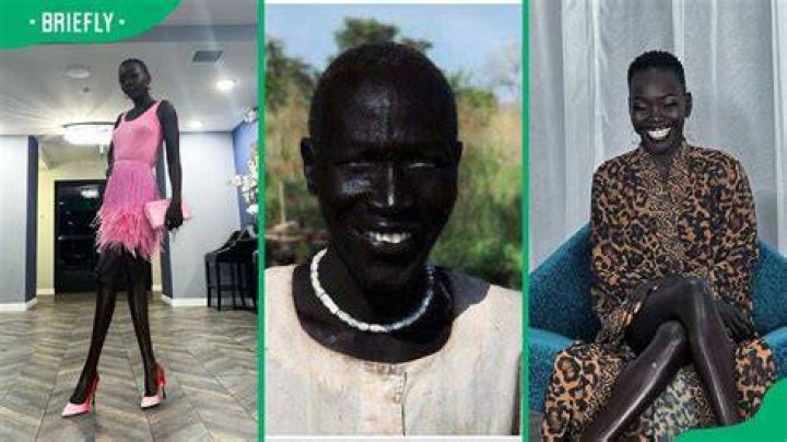 Who is the blackest person in the world, and is there a Guinness World